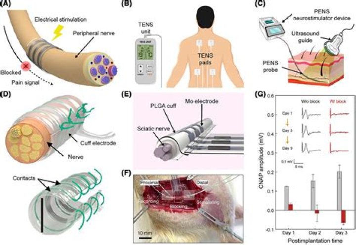 Does electrical stimulation increase blood flow?
