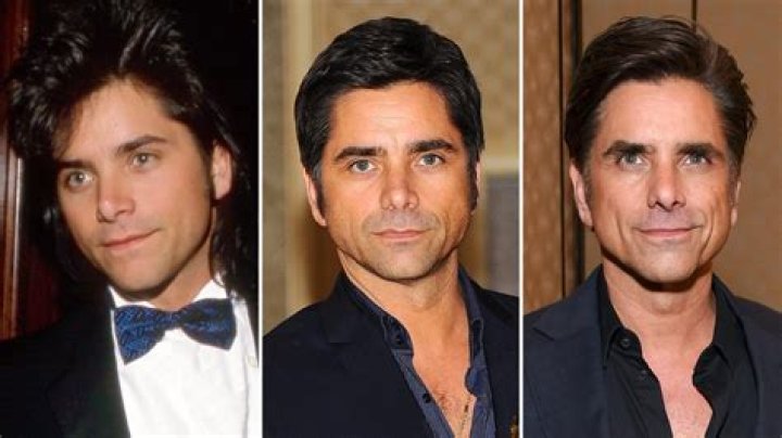 John Stamos Plastic Surgery