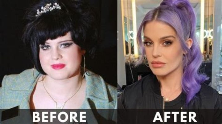 Kelly Osbourne Before And After